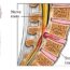 Spinal Canal Stenosis